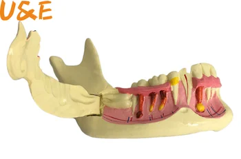 Dantų Endodontinis Gydymas Modelis Anatomija dantenas Dantų Studijų Mokyti Dantų Modelis